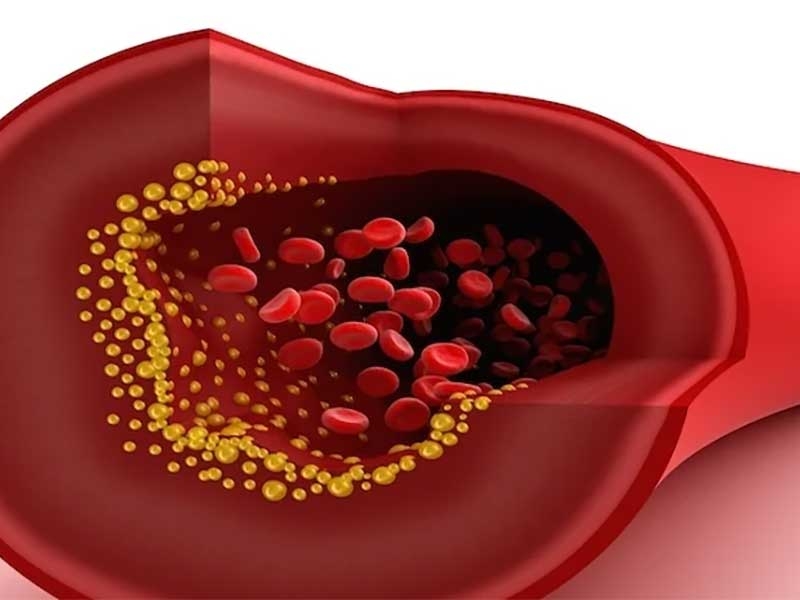 Total Cholesterol Test in Manendragarh