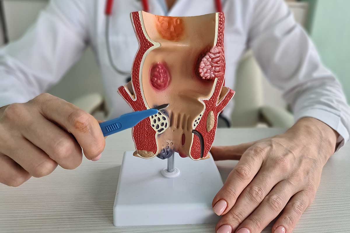 Proctologist in Rajgarh