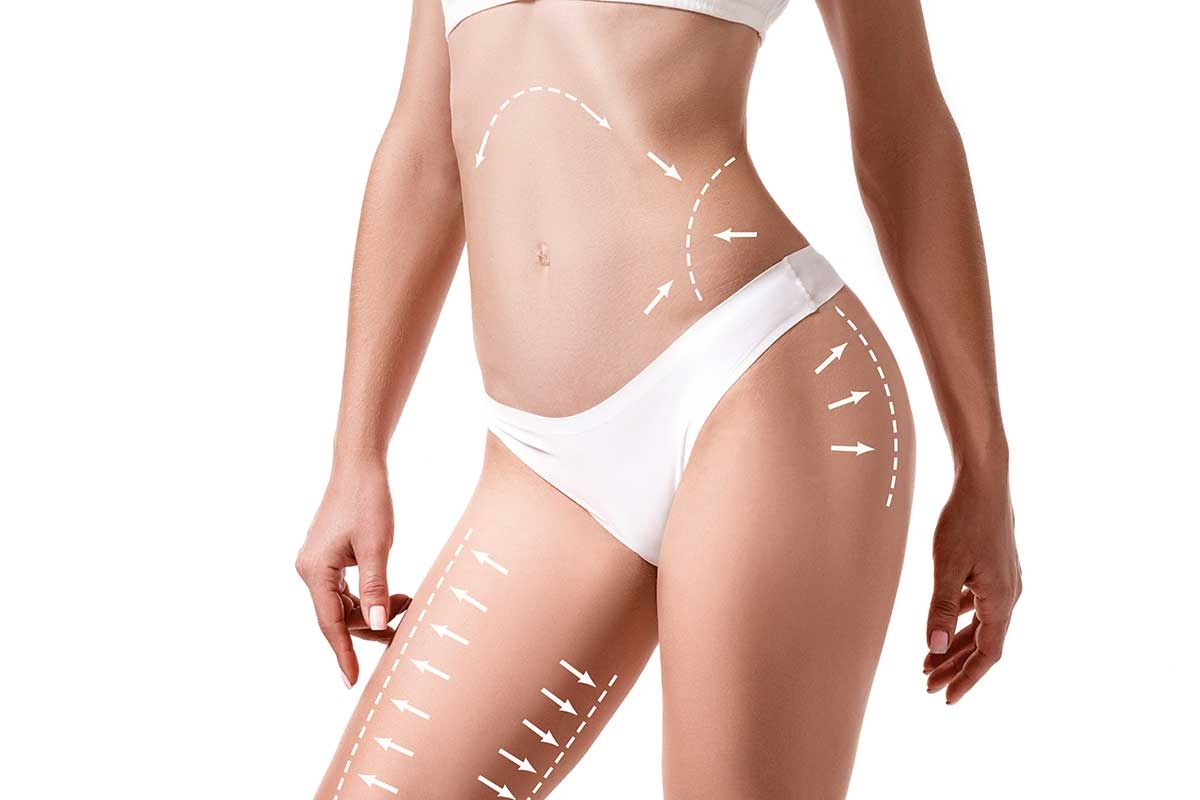 Liposuction in Pali